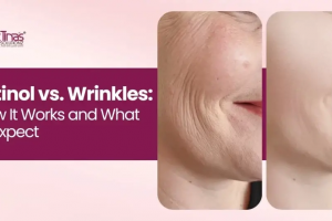 How Long Does Retinol Take To Get Rid Of Wrinkles?