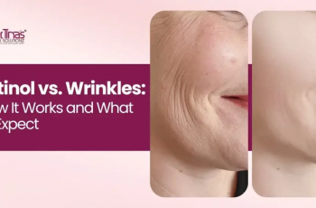 How Long Does Retinol Take To Get Rid Of Wrinkles? How Long Does Retinol Take To Get Rid Of Wrinkles?